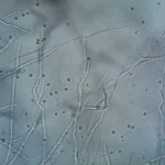 La mémoire cellulaire : comment nos cellules se souviennent des expériences passées